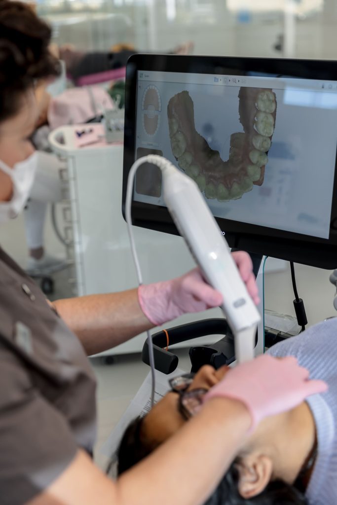 Het belang van mondhygiëne tijdens een beugelbehandeling