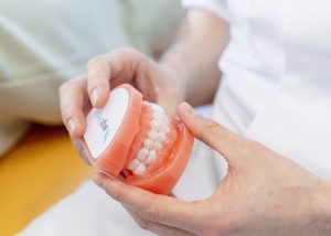 Hoe hou je je tanden wit tijdens een beugelbehandeling?
